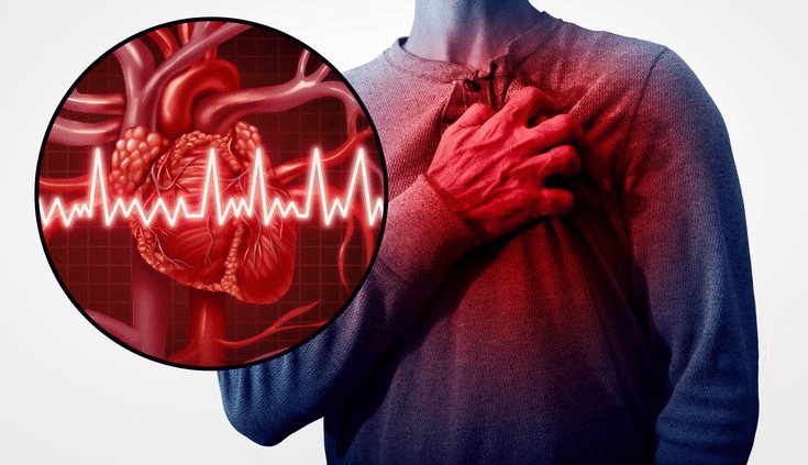 Holiday Heart Syndrome: Early Signs, Causes, and Prevention Tips